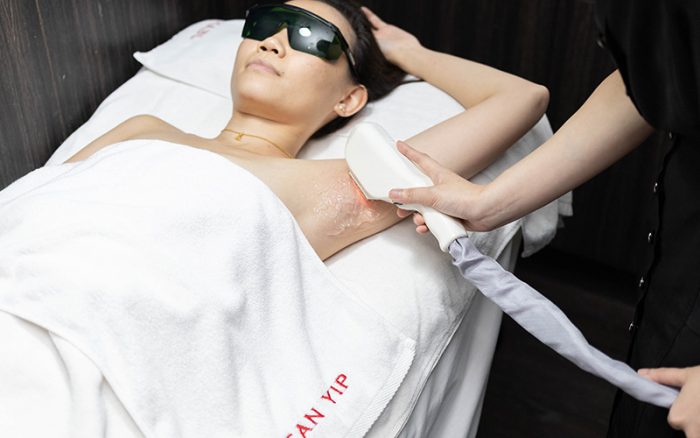 #1 IPL hair removal is painful-ipl hair removal singapore